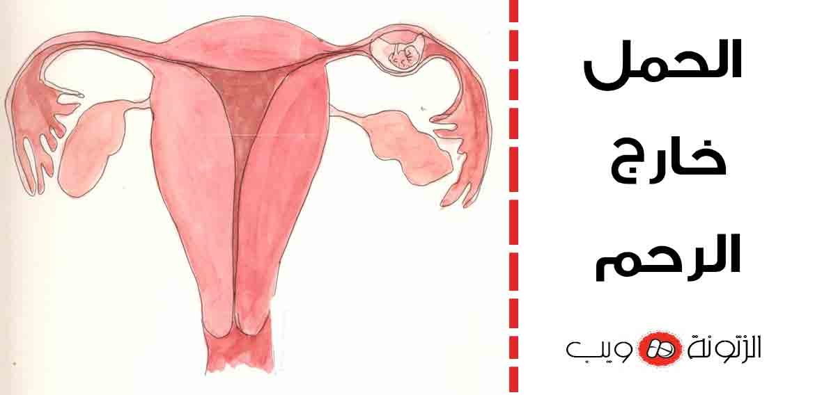 تجربتي مع الحمل خارج الرحم هي معلومات خطيرة للغاية يجب معرفتها